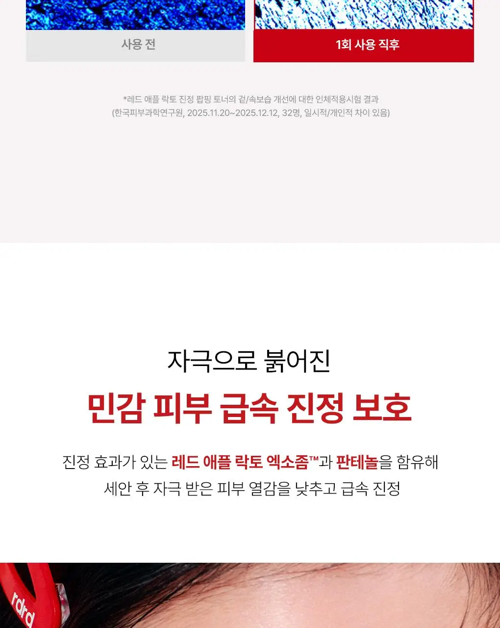 [NEW/단독기획] rdrd 레드 애플 락토 진정 팝핑 토너 95g 응급진정 KIT 기획 상세페이지 12
